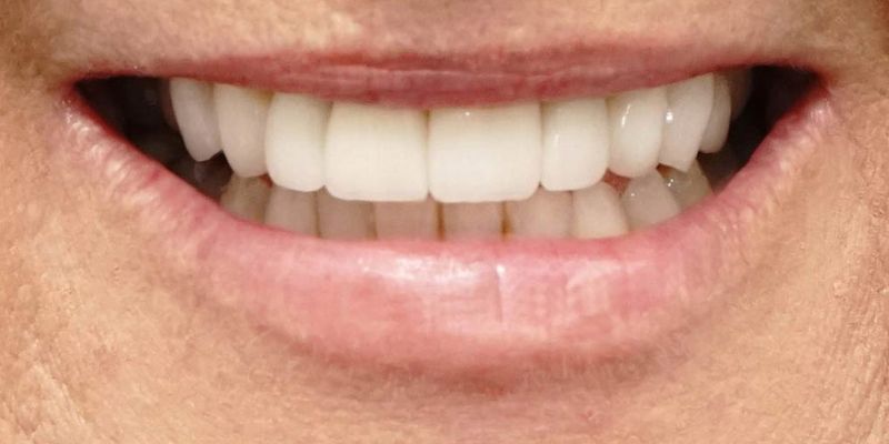 Before_After_Slide_4_After