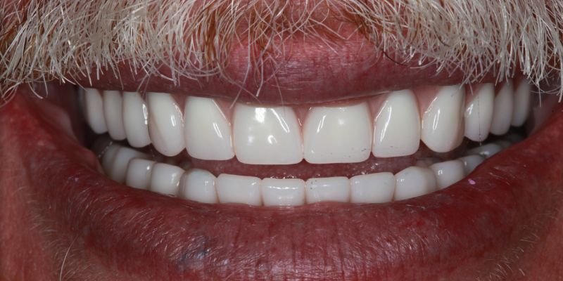 Before_After_Slide_5_After