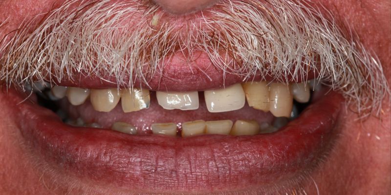 Before_After_Slide_5_Before