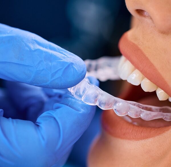 Close up of woman getting dental aligner at dentist's office.