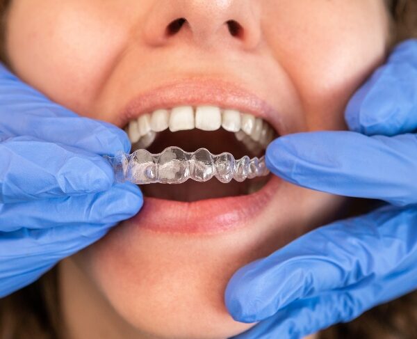 Move with Invisalign