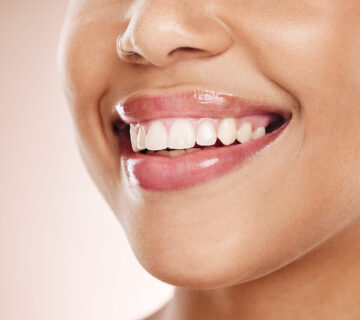 Teeth Whitening Tips