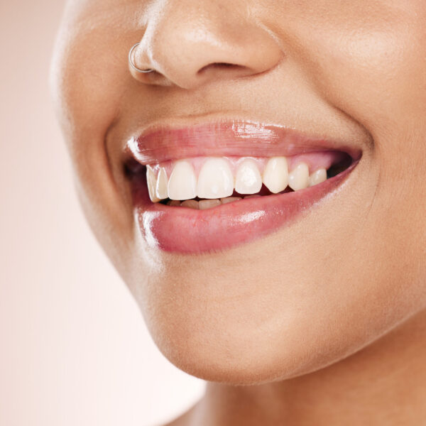 Teeth Whitening Tips