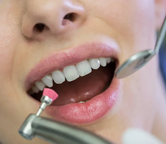 dental-cleaning-phoenix