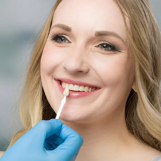 dental-veneers-in-phoenix