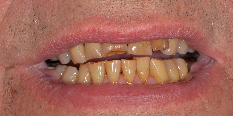 smile-gallery-4-before